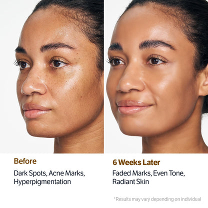 Last 3 Hours 60% OFF   ✨ SONGBOON Editor Glass Skin Collagen Volufiline Cream-in-Serum | Gentle, Nourishing &Comfort Korean Skincare Moisturizer for Firming & Hydrating