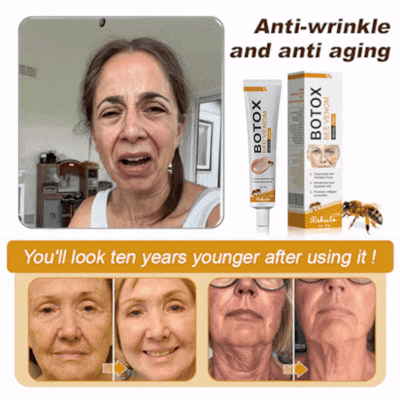 (🐝Made and Shipped from UK✅) Rekulo™ Botox Bee Venom Wrinkle Removal Cream- LAST DAY 70% OFF