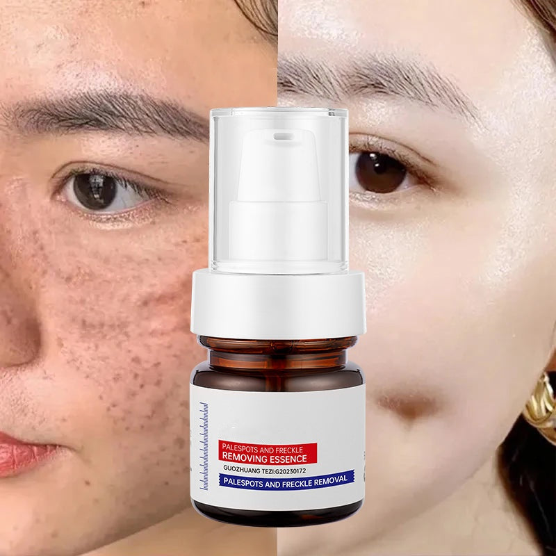 ⚡5-second brightening rescue: Dark spots disappear, blemishes fade, and skin becomes radiant! Vitamin C Whitening Freckles - Lefreniy