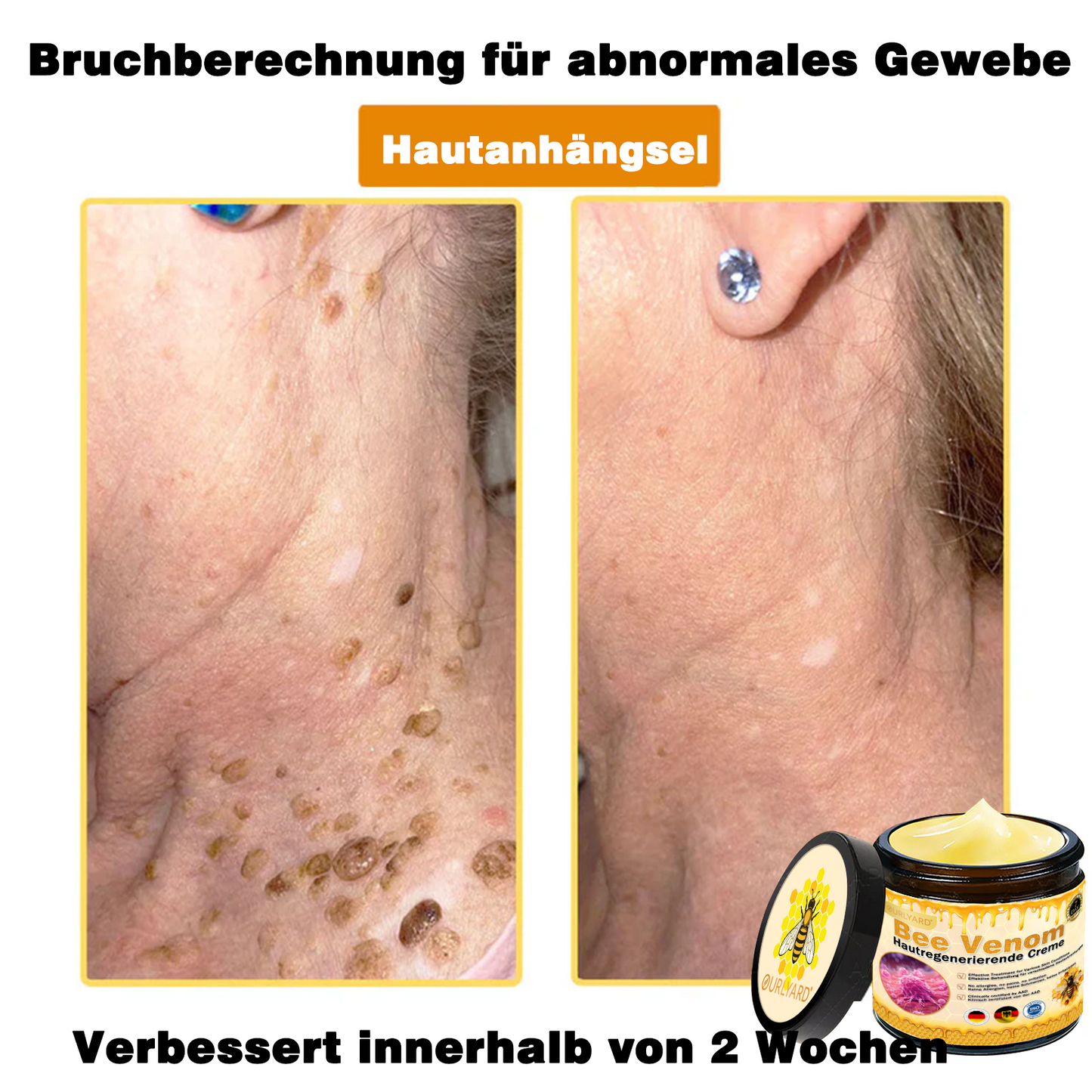 🔥Ourlyard® Bee Venom Pro Comprehensive Cream — 🔥80% OFF for a Limited Time🔥