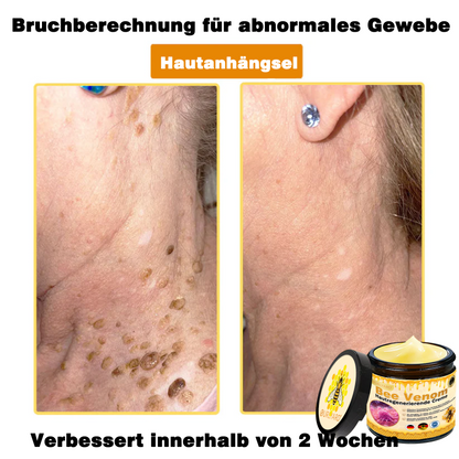 🔥Ourlyard® Bee Venom Pro Comprehensive Cream — 🔥80% OFF for a Limited Time🔥