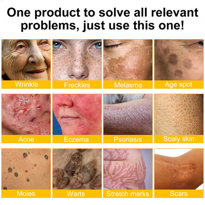 🔥Ourlyard® Bee Venom Pro Comprehensive Cream — 🔥80% OFF for a Limited Time🔥