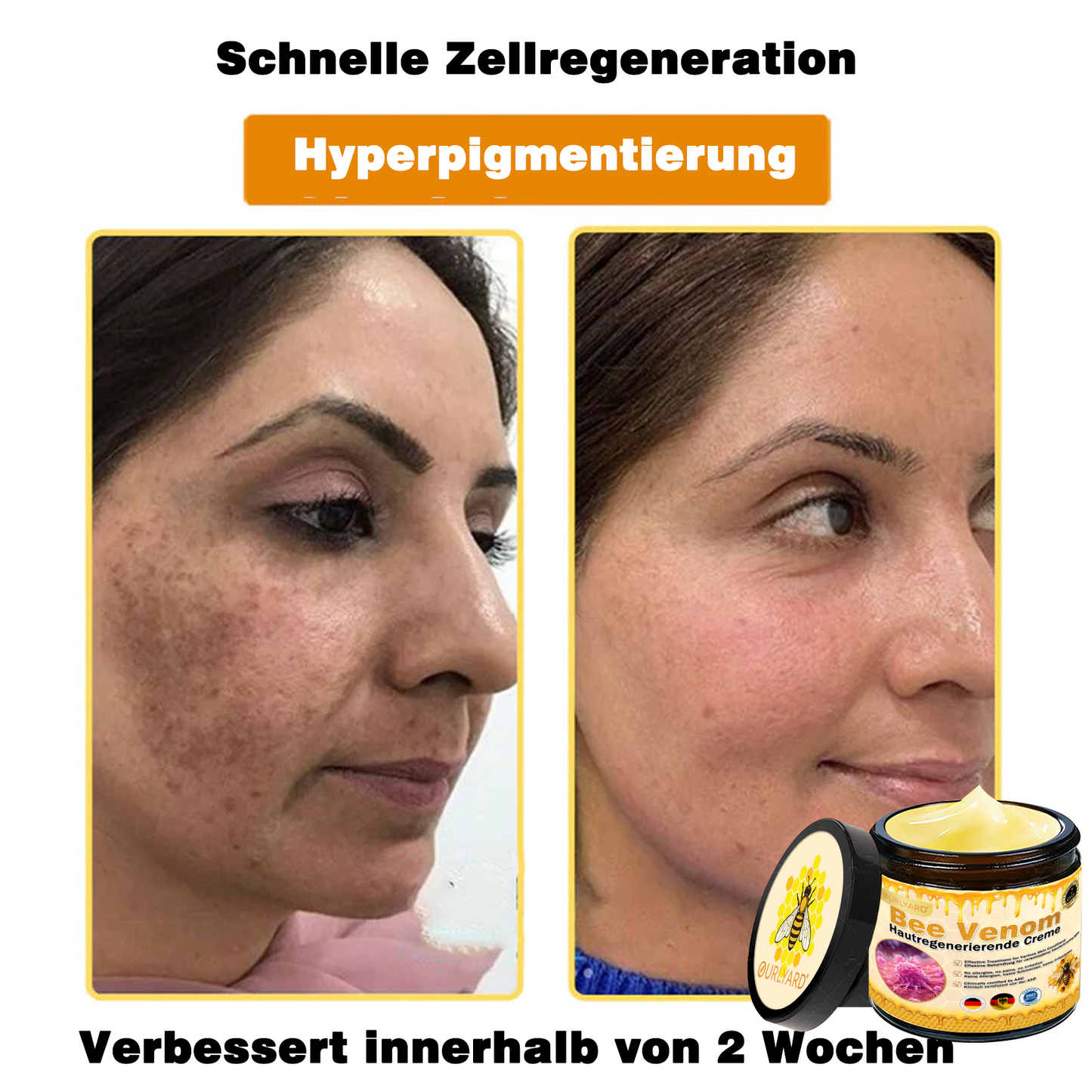 🔥Ourlyard® Bee Venom Pro Comprehensive Cream — 🔥80% OFF for a Limited Time🔥