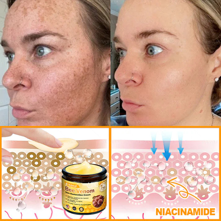 🔥Ourlyard® Bee Venom Pro Comprehensive Cream —🔥80% OFF for a Limited Time🔥