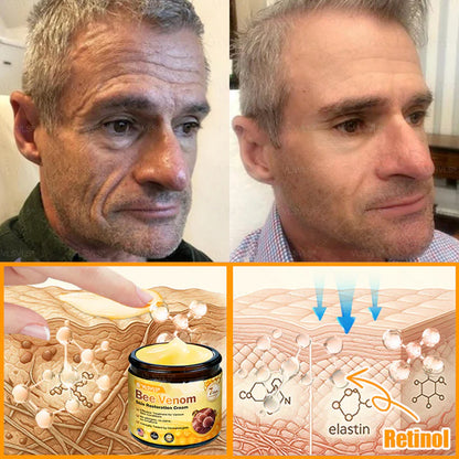🔥Ourlyard® Bee Venom Pro Comprehensive Cream —🔥80% OFF for a Limited Time🔥