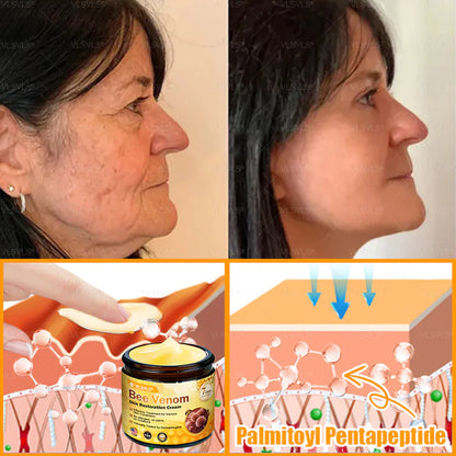 🔥Ourlyard® Bee Venom Pro Comprehensive Cream —🔥80% OFF for a Limited Time🔥