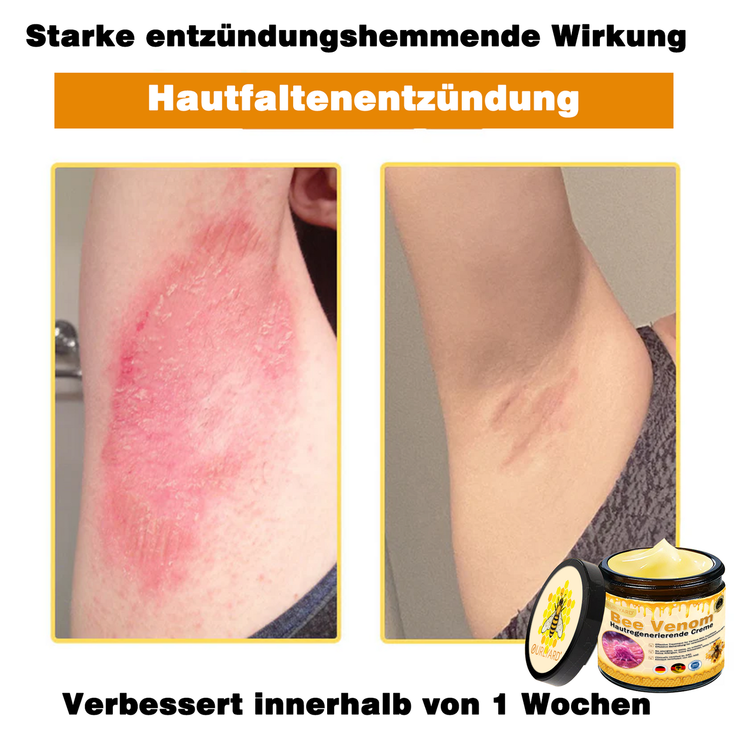 🔥Ourlyard® Bee Venom Pro Comprehensive Cream — 🔥80% OFF for a Limited Time🔥