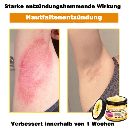 🔥Ourlyard® Bee Venom Pro Comprehensive Cream — 🔥80% OFF for a Limited Time🔥