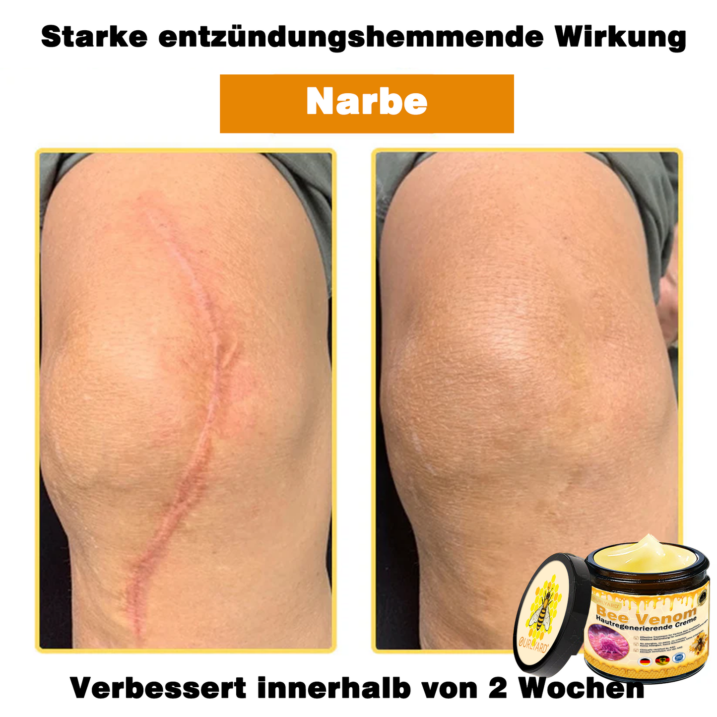 🔥Ourlyard® Bee Venom Pro Comprehensive Cream — 🔥80% OFF for a Limited Time🔥