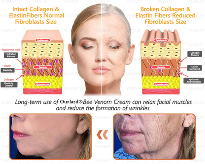 🔥Ourlyard® Bee Venom Pro Comprehensive Cream —🔥80% OFF for a Limited Time🔥