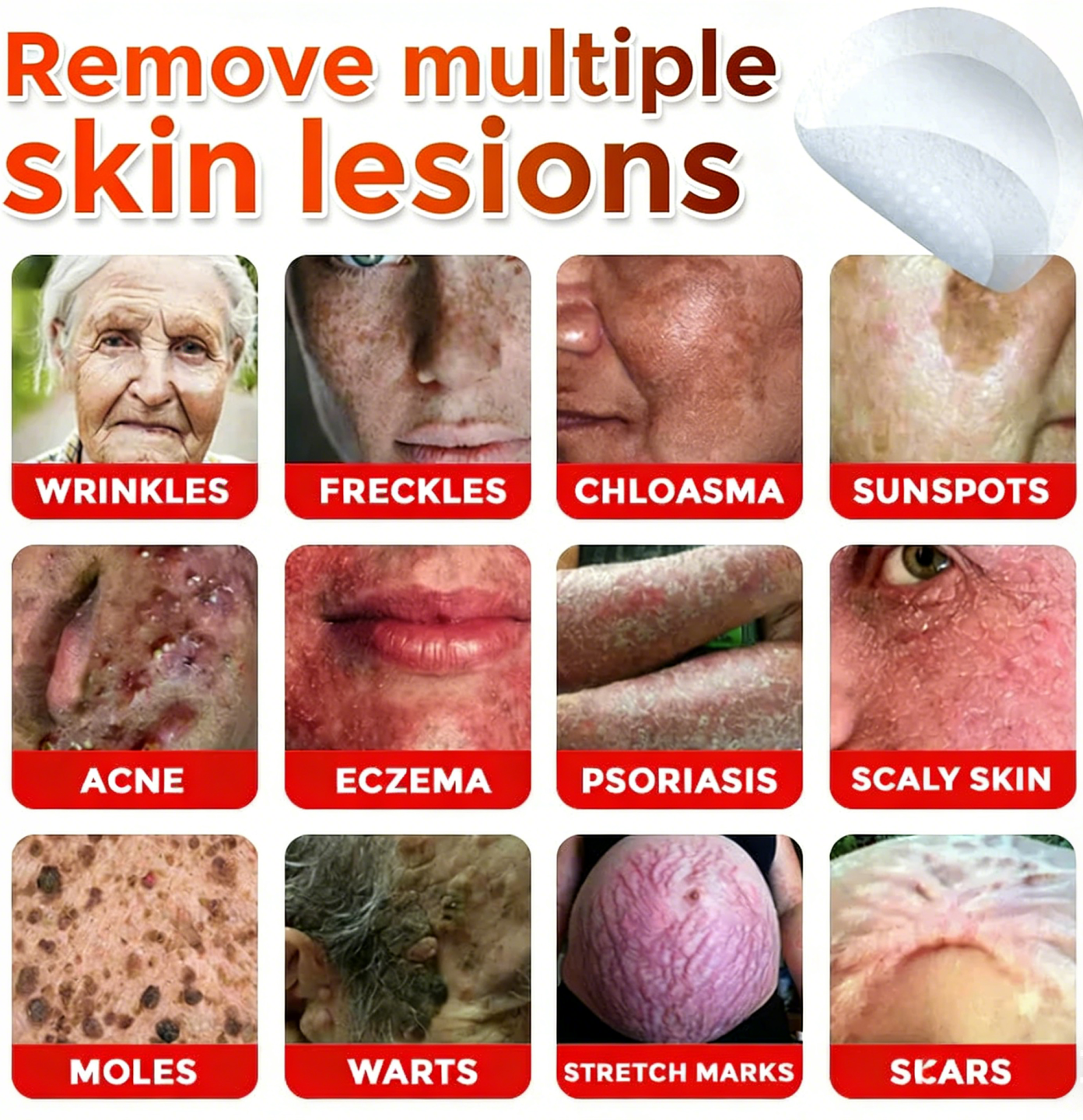 👨🏻‍⚕️🇩🇪 GFOUK® Microneedle Botanical Skin Tag Removal Patch ✅ Made in Germany