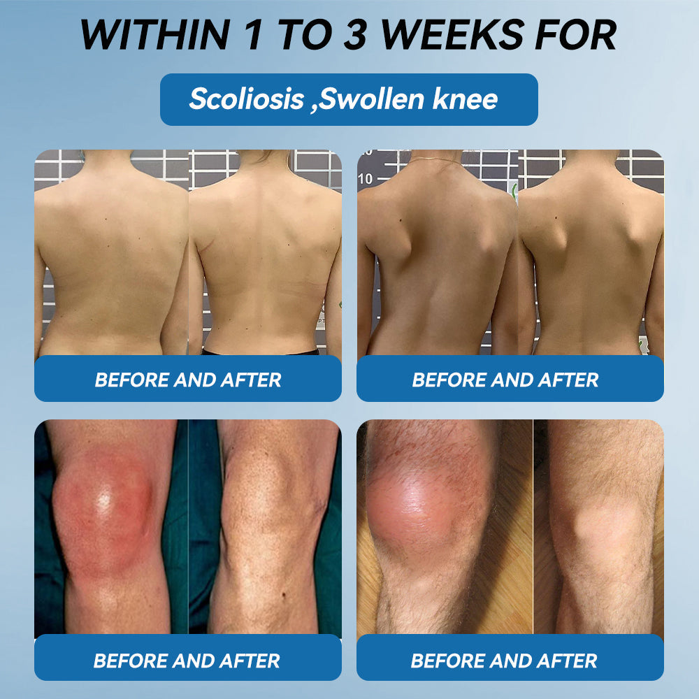 𝖯𝗂𝖼𝗱𝗼® BPC-157 Joint Healing Cream🦴Treats Arthritis, Neuropathy, Rheumatism, Sports Injuries & More-USA👍