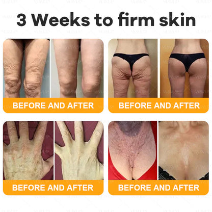 🔥Ourlyard® Bee Venom Pro Comprehensive Cream —🔥80% OFF for a Limited Time🔥