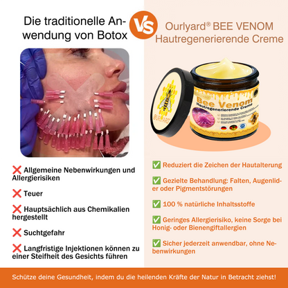 🔥Ourlyard® Bee Venom Pro Comprehensive Cream — 🔥80% OFF for a Limited Time🔥