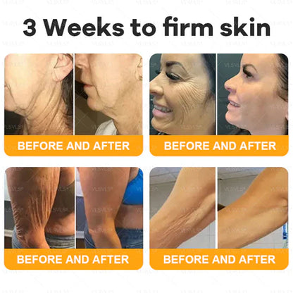 🔥Ourlyard® Bee Venom Pro Comprehensive Cream —🔥80% OFF for a Limited Time🔥