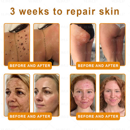 🔥Ourlyard® Bee Venom Pro Comprehensive Cream —🔥80% OFF for a Limited Time🔥