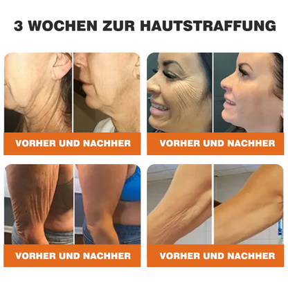 🔥Ourlyard® Bee Venom Pro Comprehensive Cream — 🔥80% OFF for a Limited Time🔥