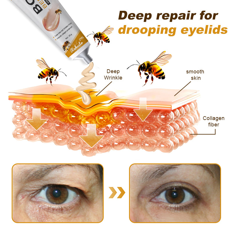 (🐝Made and Shipped from UK✅) Rekulo™ Botox Bee Venom Wrinkle Removal Cream- LAST DAY 70% OFF