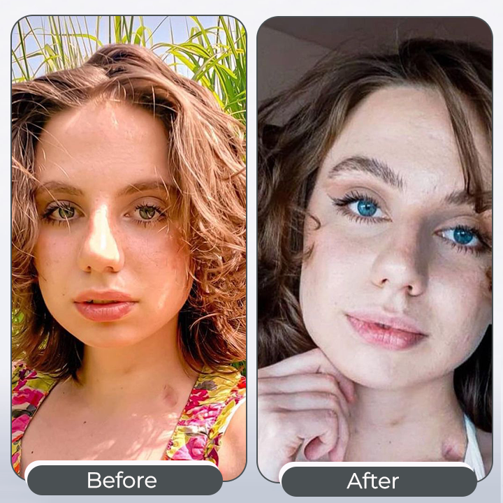 𝑺𝒑𝒆𝒄𝒕𝒓𝒂𝑬𝒚𝒆 𝑪𝒐𝒍𝒐𝒓 𝑪𝒉𝒂𝒏𝒈𝒊𝒏𝒈 𝑫𝒓𝒐𝒑𝒔 𝑷𝒓𝒐 - Lefreniy