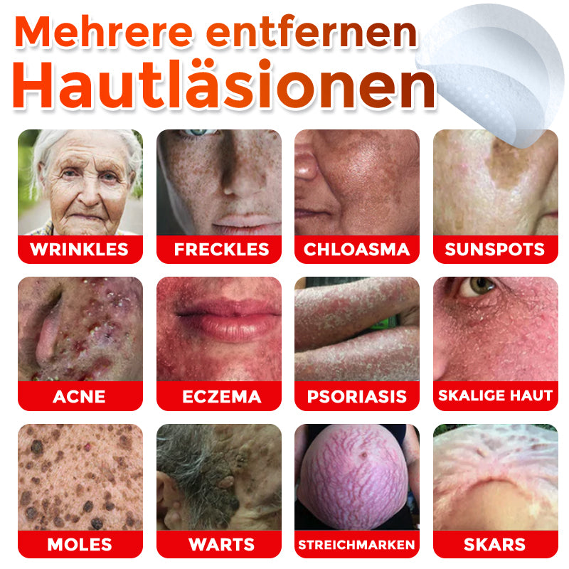 👨🏻‍⚕️🇩🇪 GFOUK® Mikronadel-Botanisches Hautanhängsel-Entfernungspflaster ✅ Hergestellt in Deutschland