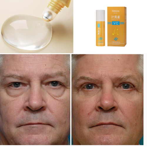 Rolon Ultra Rejuvenesced 5-in-1 Letein Glow - Lefreniy