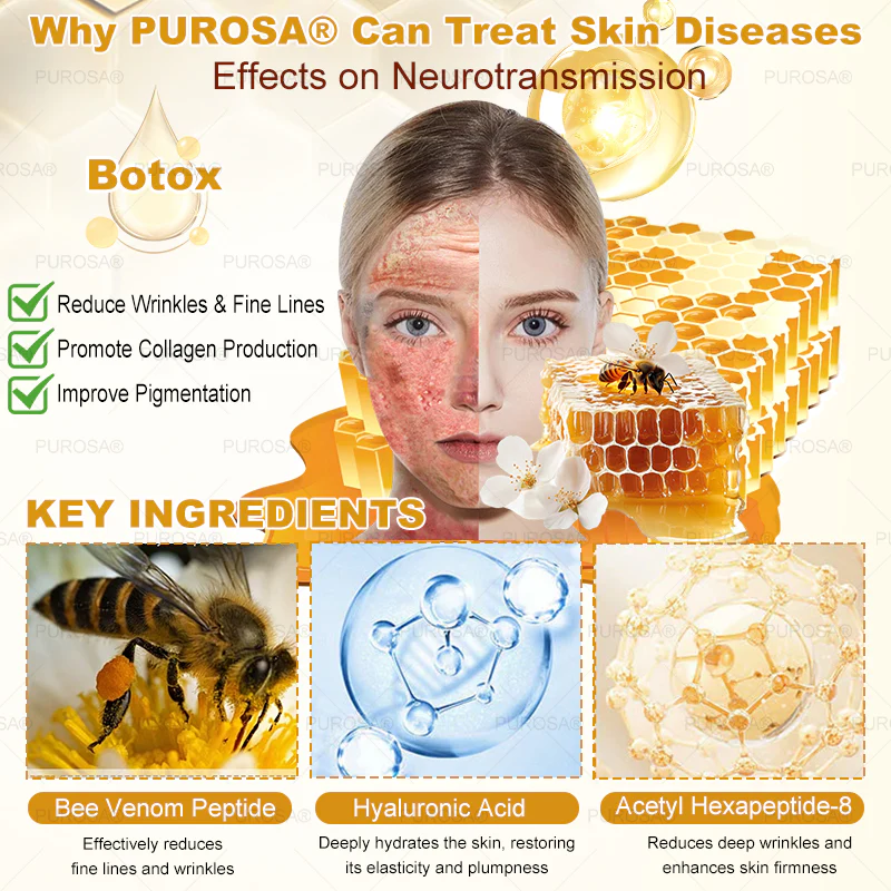 🐝PUROSA® Bee Venom Skin Treatment Cream, Anti-aging, Hydrating, Skin Repair, Even Tone, Acne and Dark Spot Treatment, Wart and Mole Removal, Psoriasis Relief