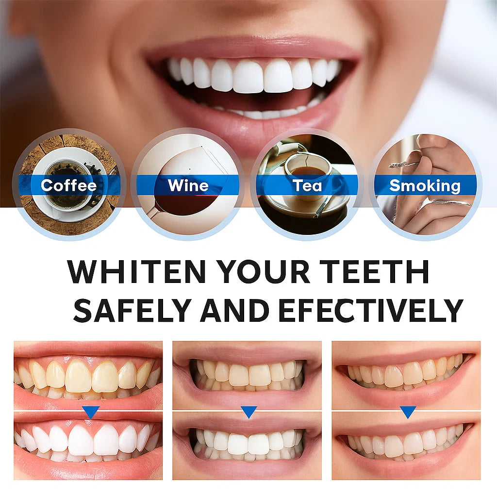 Instant Bright Teeth Whitening Essence Pen – Gentle & Sensitivity-Free - Lefreniy