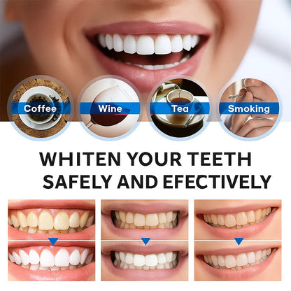 Instant Bright Teeth Whitening Essence Pen – Gentle & Sensitivity-Free - Lefreniy