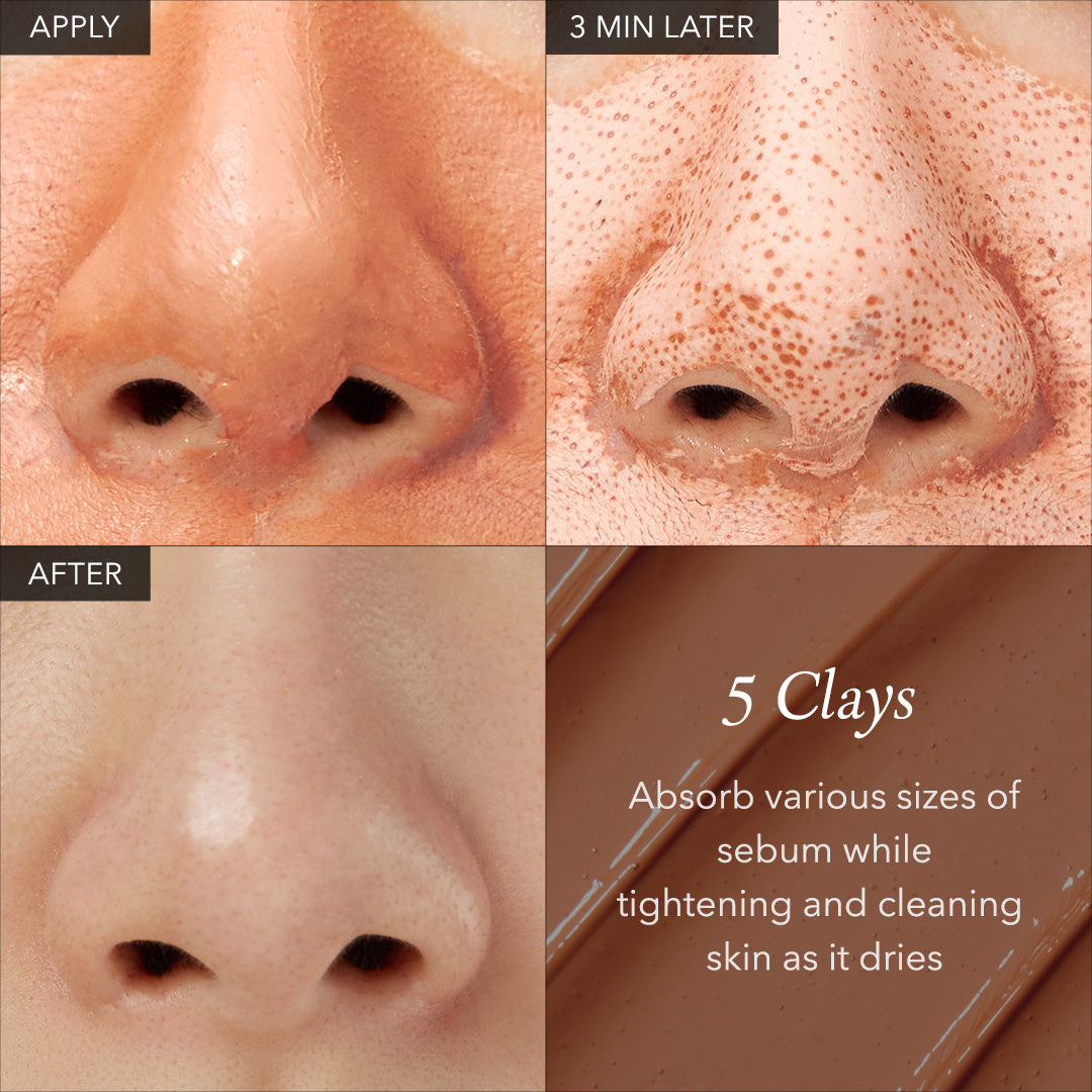 🎁🎁Limited-Time Promotion: 25% Off for 1 Item, 35% Off for 2 Items：Carrotene IPMP™ Quick Dry Pore Tightening Clay Mask - Lefreniy