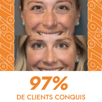 Instant Eye Cream for Dark Circles and Wrinkles