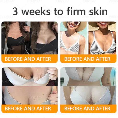 🔥Ourlyard® Bee Venom Pro Comprehensive Cream —🔥80% OFF for a Limited Time🔥